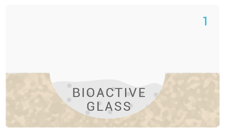 noraker_schema_bioglass_synthes3d_v4-01