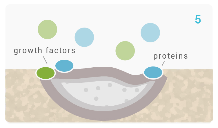 noraker_schema_bioglass_synthes3d_v4-05